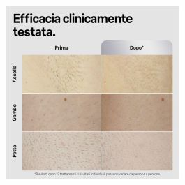 Braun Depiladora de Luz Pulsada IPL PL5145 Blanco, Verde y Negro