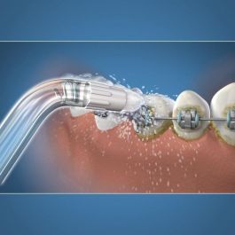 Waterpik WAT0073950290517 Punta de Irrigador Dental para Ortodoncia - Elimina Placa y Limpia Aparatos Dentales Waterpik WAT0073950290517 Punta de Irrigador Dental para Ortodoncia - Elimina Placa y Limpia Aparatos Dentales