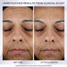 Lancôme Rénergie H.P.N 300-peptide Crema Anti-Edad 50 ml - Firmeza, Reducción de Arrugas y Tono Uniforme