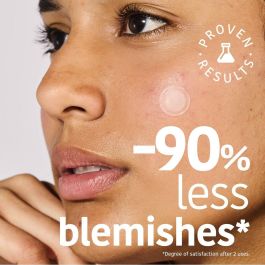 Iroha Parches Para Granos Con Microdardos Y Ácido Salicílico Acne Prone Skin 12 u