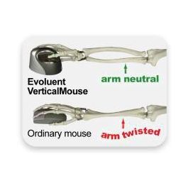 Evoluent VerticalMouse 4 Small Ratón Ergonómico USB para Windows XP/7/Vista con 6 Botones y Sensor Láser Ajustable