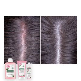 Klorane Serum SOS Pivoine 100ml Cabello Calmante