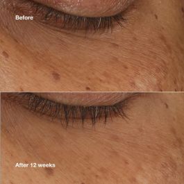 Clinique ALL ABOUT EYES Sérum Iluminador Concentrado 10 ml - Revitaliza y Ilumina el Contorno de Ojos