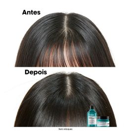 L'Oreal Champú Scalp Advanced para Cuero Cabelludo Graso 500ml