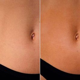 Clarins Gel Autobronceador Express Self-Tanning para Rostro y Cuerpo, 125 ml - Bronceado Natural y Uniforme sin Sol