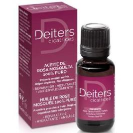 Rosa Mosqueta Aceite 100%Puro 15Ml. Precio: 14.49999991. SKU: B12V3SJGEF