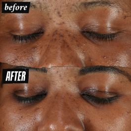 Kiehl'S Dermatologist Solutions Clearly Corrective Dark Spot Serum 100 ml