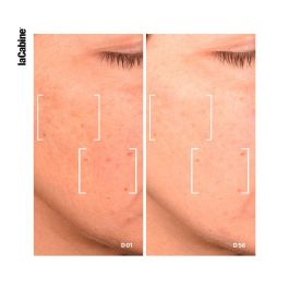 La Cabine 25% Niacinamide Pro Complex Advanced Serum 30 mL La Cabine 25% Niacinamide Pro Complex Advanced Serum 30 mL
