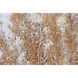 Cuadro Mediterraneo DKD Home Decor Dorado Azul 3 x 80 x 80 cm (2 Unidades)