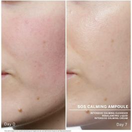 Tratamiento Facial Babor Sos Calming