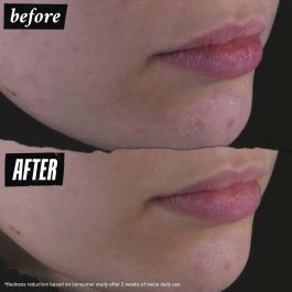 Gel Limpiador Facial Kiehl's CALENDULA