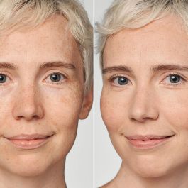 Clinique EVEN BETTER CLINICAL foundation SPF20 #08-linen Base de maquillaje - Suero 30ml