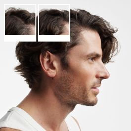 Nioxin Sistema 2 - Kit Tratamiento Cabello Natural con Debilitamiento Avanzado 3 Pasos (3 unidades)