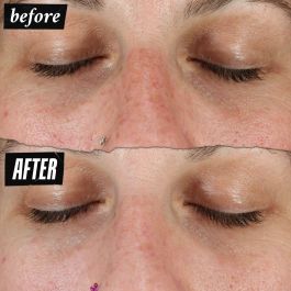 Kiehl'S Dermatologist Solutions Clearly Corrective Dark Spot Serum 100 ml