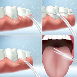 Irrigador Dental Recargable Portátil Denter InnovaGoods